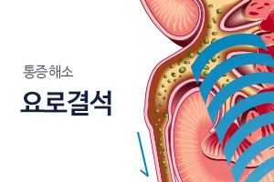 요로결석