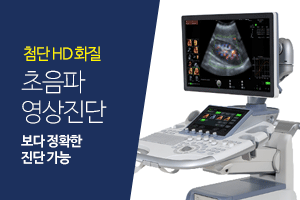 영상진단장치